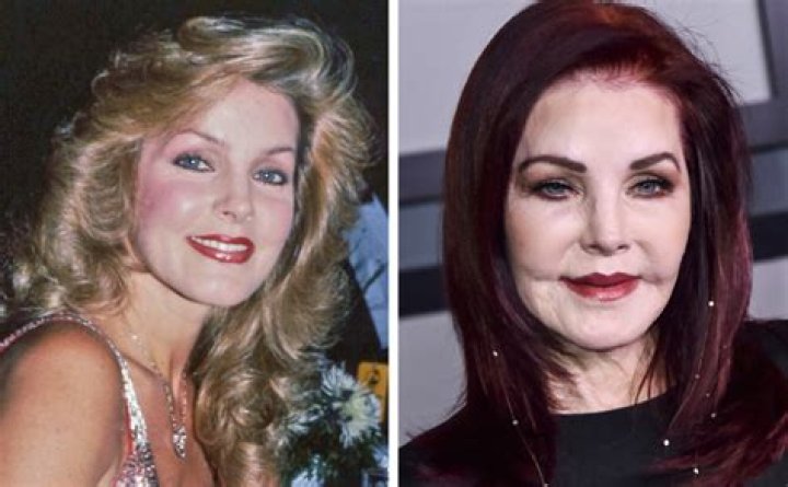 13 Celebrities Who Had Plastic Surgery and Don't Regret it — Celebwell