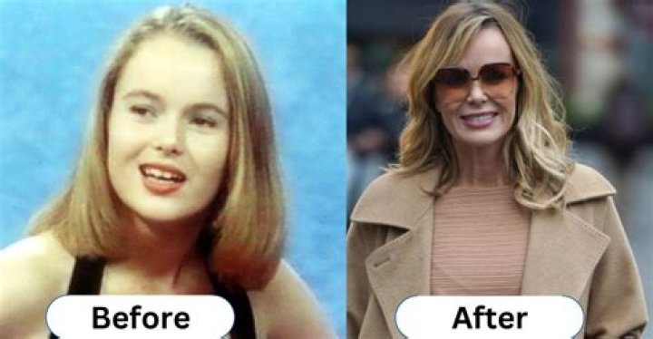 Amanda Holden Plastic Surgery: From Natural to Enhanced 