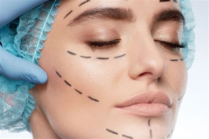Jackie Sandler Plastic Surgery: Is Her Timeless Look a Result of Cosmetic Procedures?