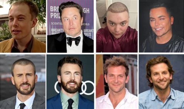 Joel McHale Plastic Surgery: Probability of Undergoing Different Surgical Procedures!