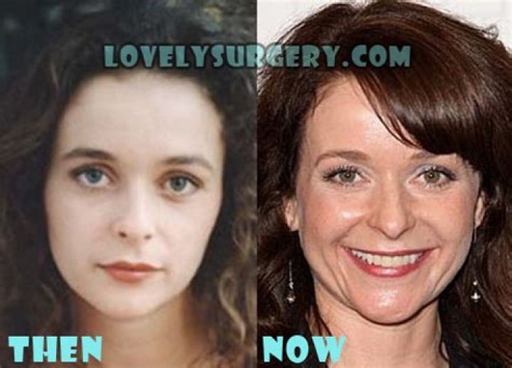 Julia Sawalha Plastic Surgery: Julia's Unexplicit Journey of Undergoing Surgery!