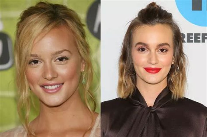 Leighton Meester Plastic Surgery Before and After