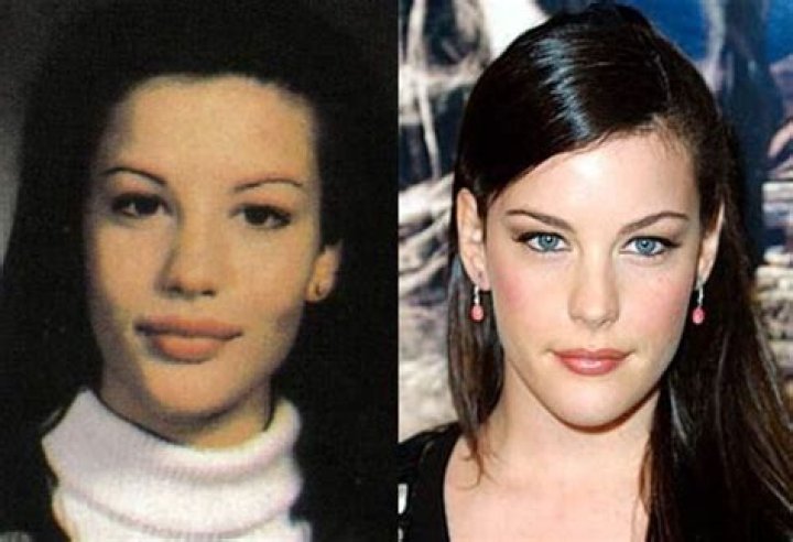 Liv Tyler Plastic Surgery Before and After