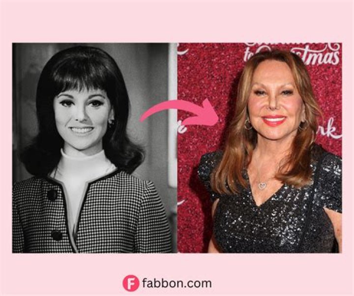 Marlo Thomas Plastic Surgery: Aging Gracefully or Going Under the Knife?
