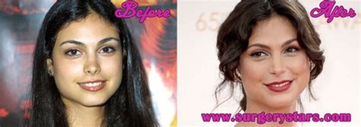 Morena Baccarin Plastic Surgery Before and After