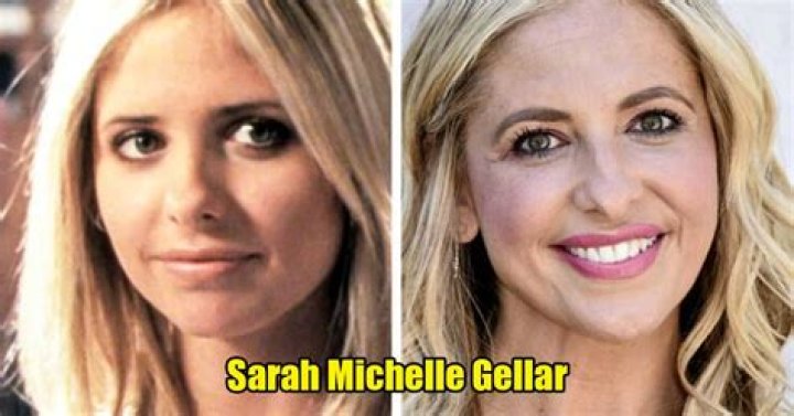 Sarah Michelle Gellar Plastic Surgery Before and After